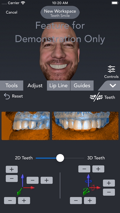 Bellus3D Dental Pro
