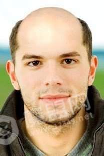 秃头生成器中文版